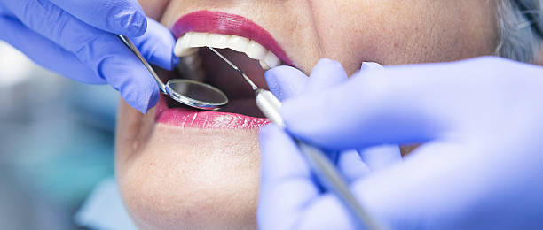 Best Emergency Dentist for Knocked-Out Tooth in Clinton, UT