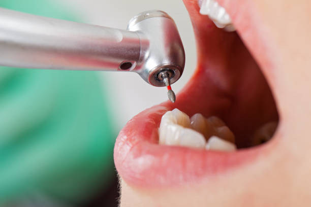 Best Emergency Dental Services for Seniors in Clinton, UT